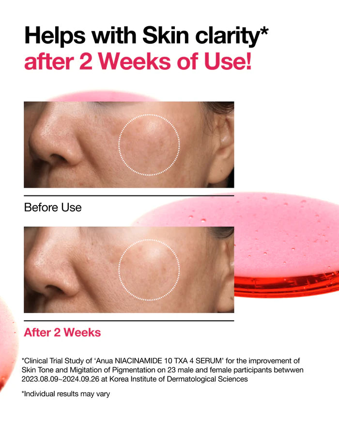 Anua Niacinamide 10% + TXA 4% Serum – 30 ml