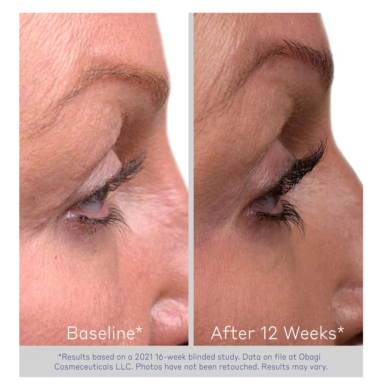 Obagi Medical Nu-Cil Eyelash Enhancing Serum